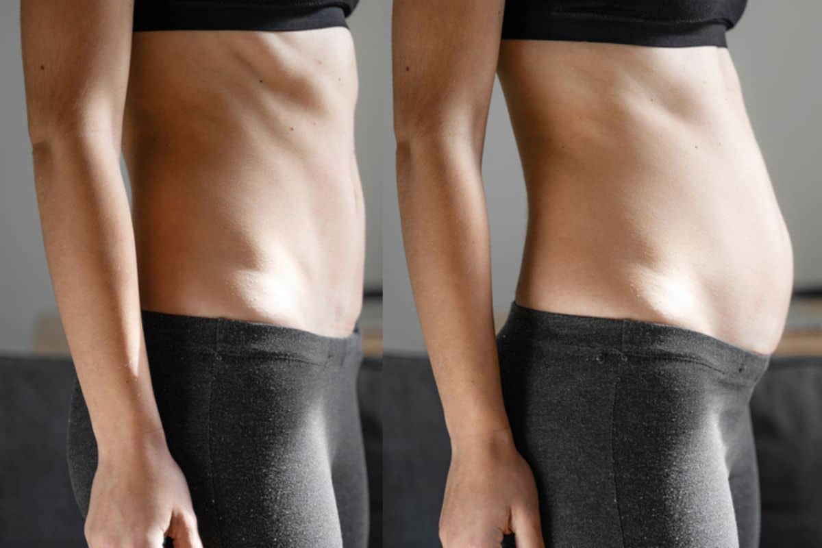 How long does diastasis recti take to improve Potters Bar?