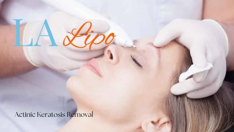 Woman receiving Actinic Keratosis Removal Treatment Potters Bar