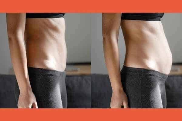 LA-EMS Body Sculpting results Potters Bar