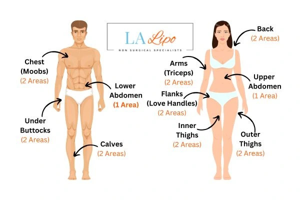 LA LIPO Cryolipolysis Areas Potters Bar