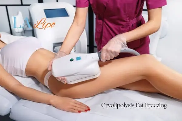 Woman receiving coolsculpting Potters Bar treatment on her thighs