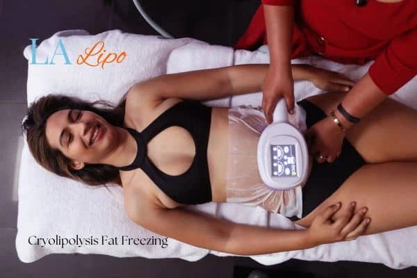 woman getting cryolipolysis Potters Bar