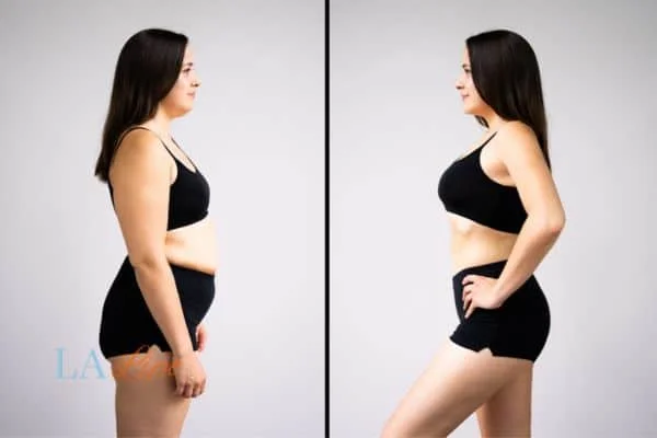 link between body image and mental health Potters Bar