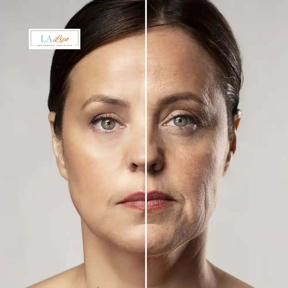 How Can You Tell If Non-Surgical Skin Tightening Is Right for You Potters Bar?