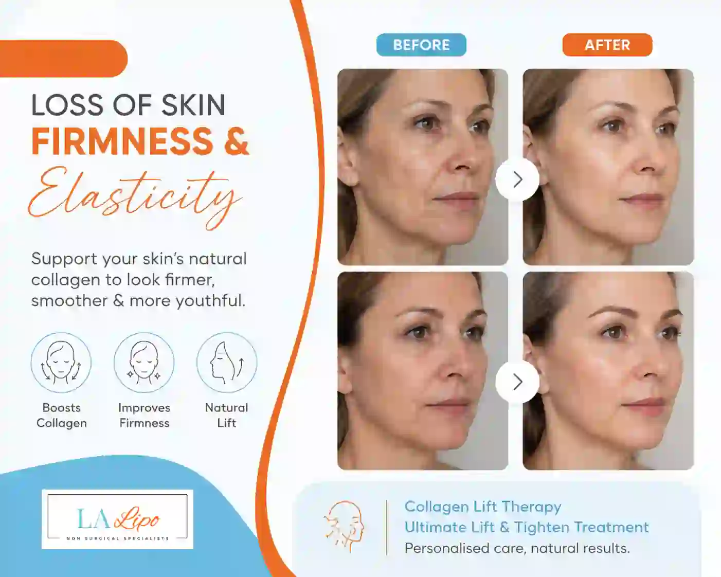Sign #7: Loss of Skin Firmness and Elasticity Potters Bar