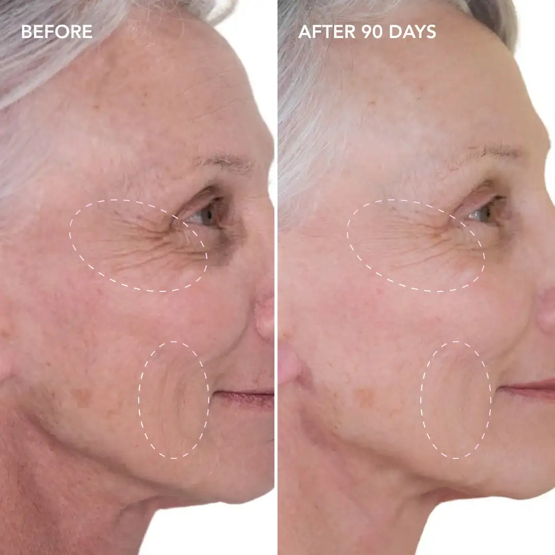 When will you see results Potters Bar